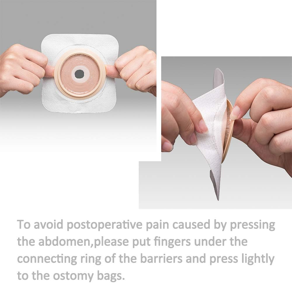 21 PCS (15Pcs Bags+6Pcs Barrier) Ostomy Supplies Colostomy Bags Two Piece Drai